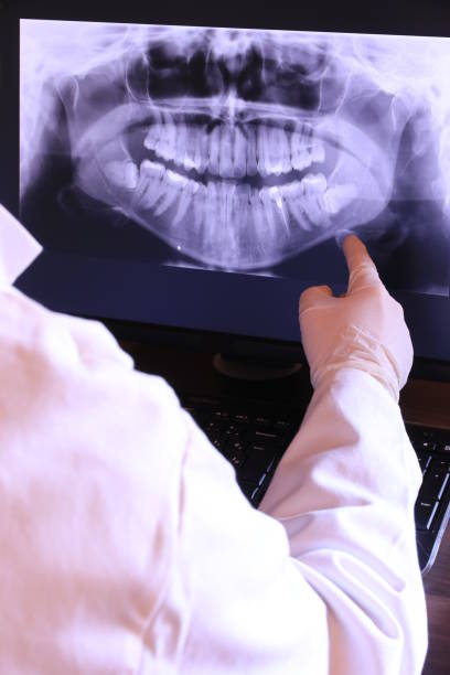 Best Broken or Chipped Tooth Repair in Manning, SC